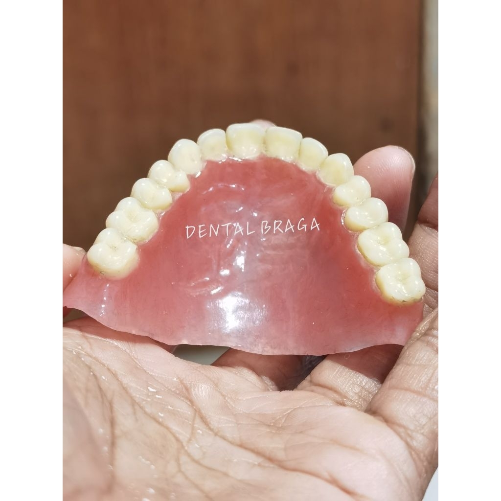 gigi tiruan lepasan/ gigi palsu