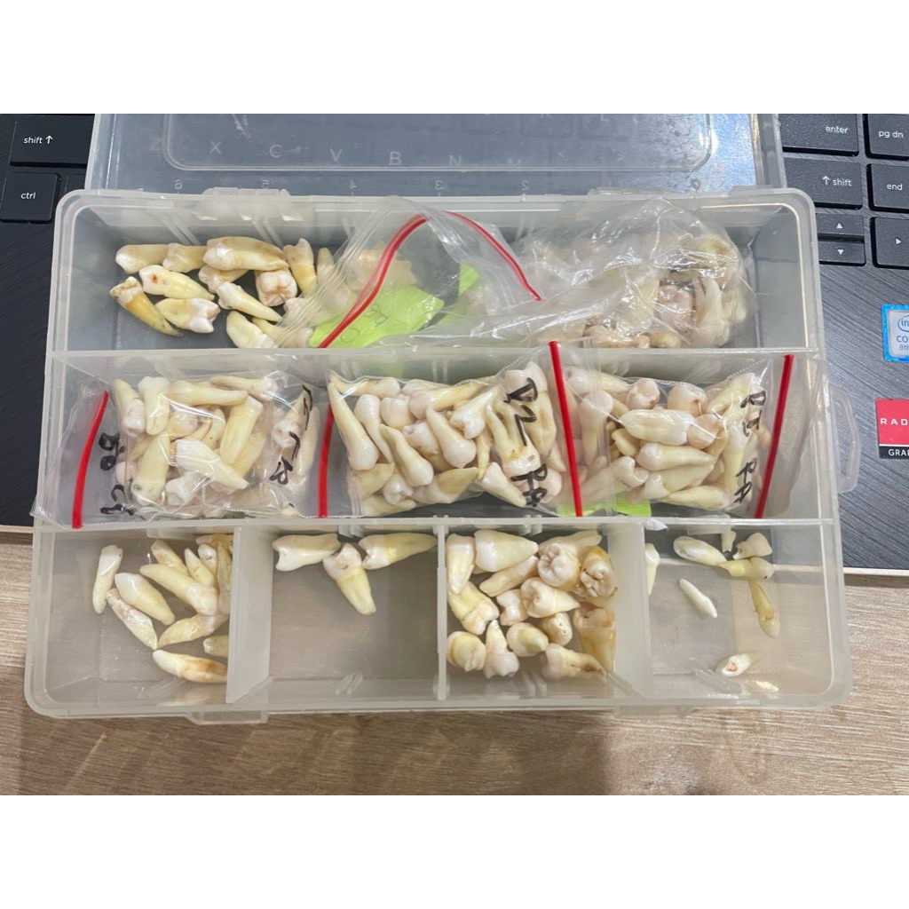 [OBRAL Murah] Gigi Asli Permanen Gigi Sulung Gigi Praktikum FKG free karies Gigi Insisivus Caninus P