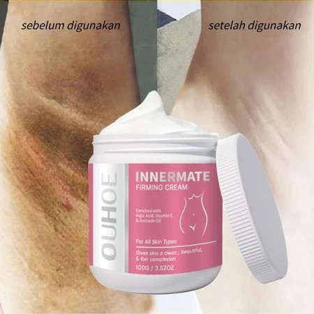 Krim pemutih ketiak 100g Pemutih Selangkangan Vagina Pemutih selangkangan Pencerah ketiak Selangkang