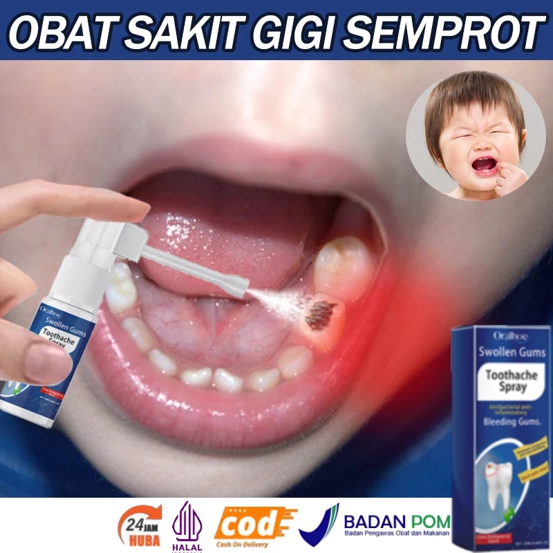 Obat sakit gigi berlubang Obat sakit gigi ampuh Obat sakit gigi semprot Obat sakit gigi anak 20ml sa