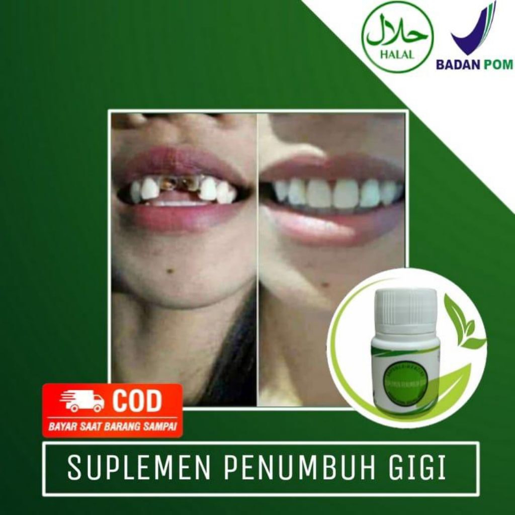 SUPLEMEN PENUMBUH GIGI BOLONG KROPOS DAN OMPONG PERMANEN