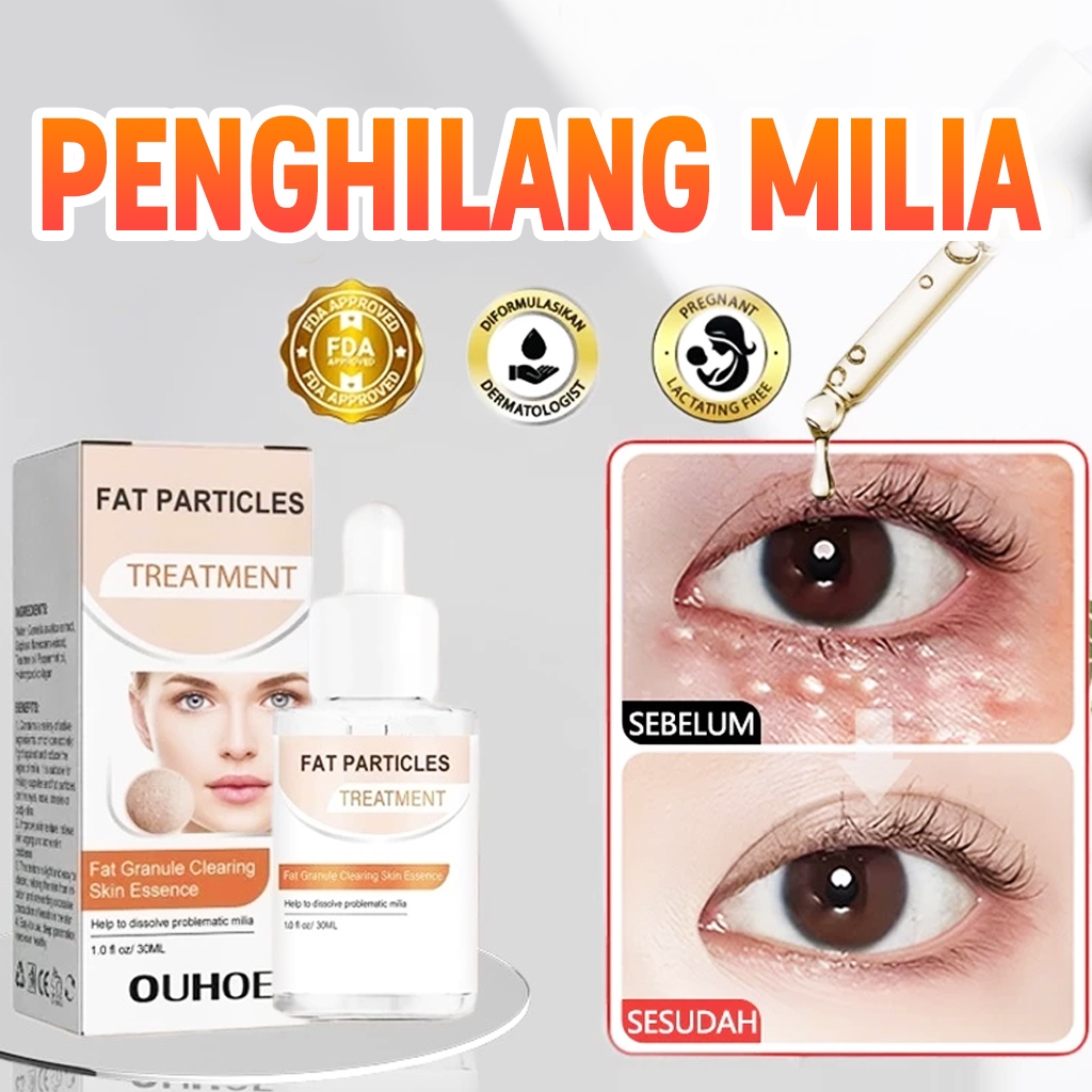 OUHOE Serum Penghilang Milia Paling Ampuh Obat Milia Serum Milia Milia Di Bawah Mata Serum Milia Di 