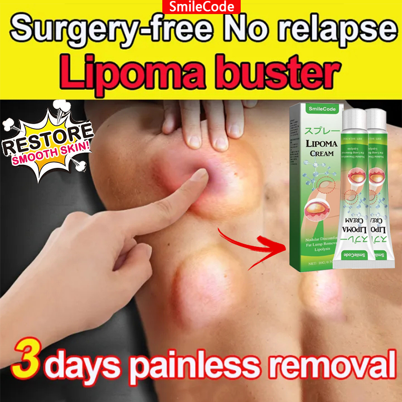 Japan Lipoma cream original obat benjolan obat lipoma 20g Sakit Gembur-Gembur Benjolan Kepala Tonjol