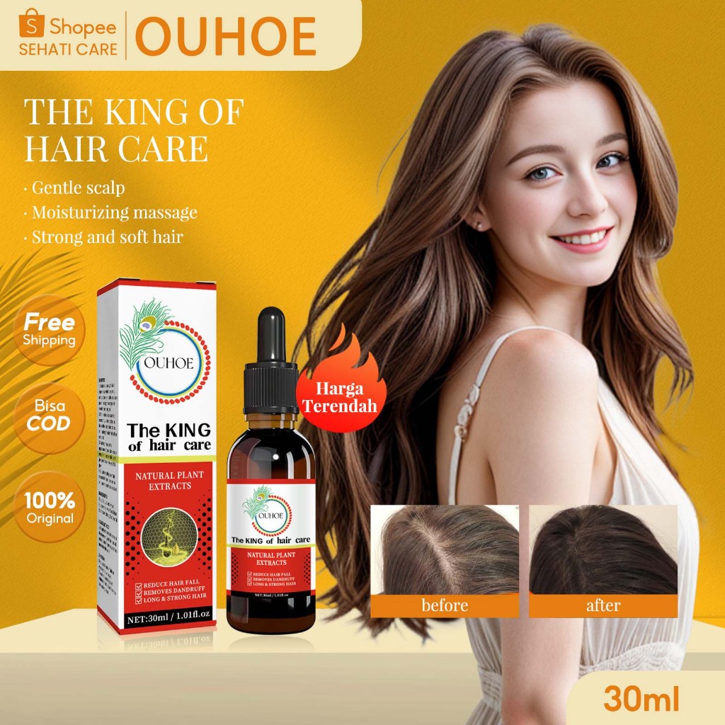 OUHOE The King Of Hair Care Hair Care Essential Oil 30ml Minyak Esensial Perawatan Rambut Reduce Hai