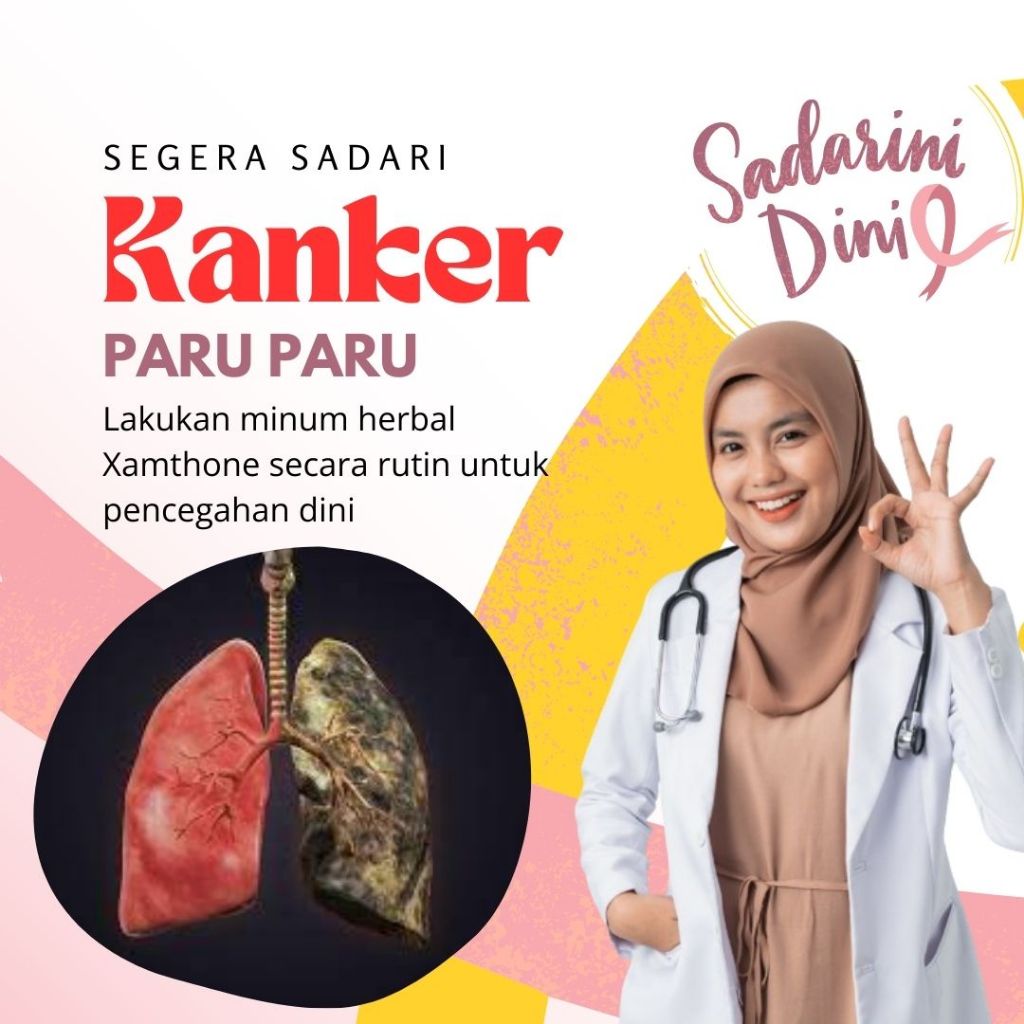 Obat Herbal Kanker Paru Paru Terbukti