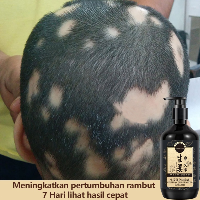 sampo penumbuh rambut cepat 300ml Shampoo Jahe Alami Shampo Anti Rambut Rontok Rambut Cepat Panjang 