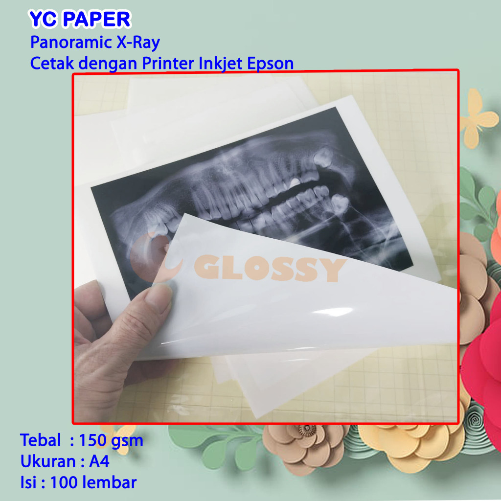 YC Paper Panoramic X-Ray Cetak dengan Printer Inkjet Epson