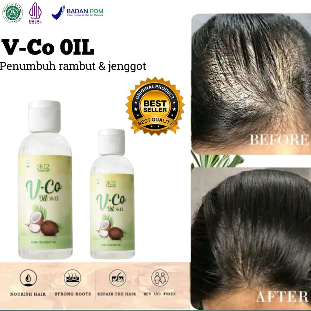 TERLARIS - Penumbuh rambut pria cepat - Penumbuh rambut botak - Penumbuh rambut cepat - Penumbuh ram