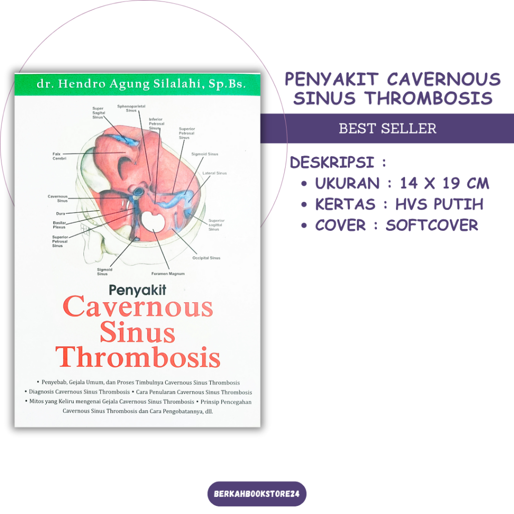 Buku Penyakit Cavernous Sinus Thrombosis - Dr Hendro Agung Silalahi