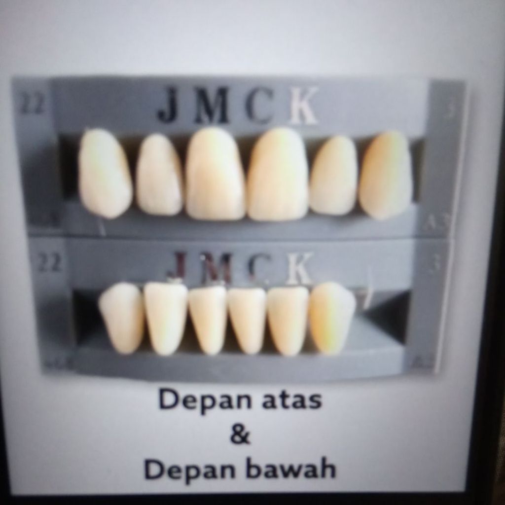 PAKET BUNDLING GIGI PALSU DEPAN ATAS & DEPAN BAWAH