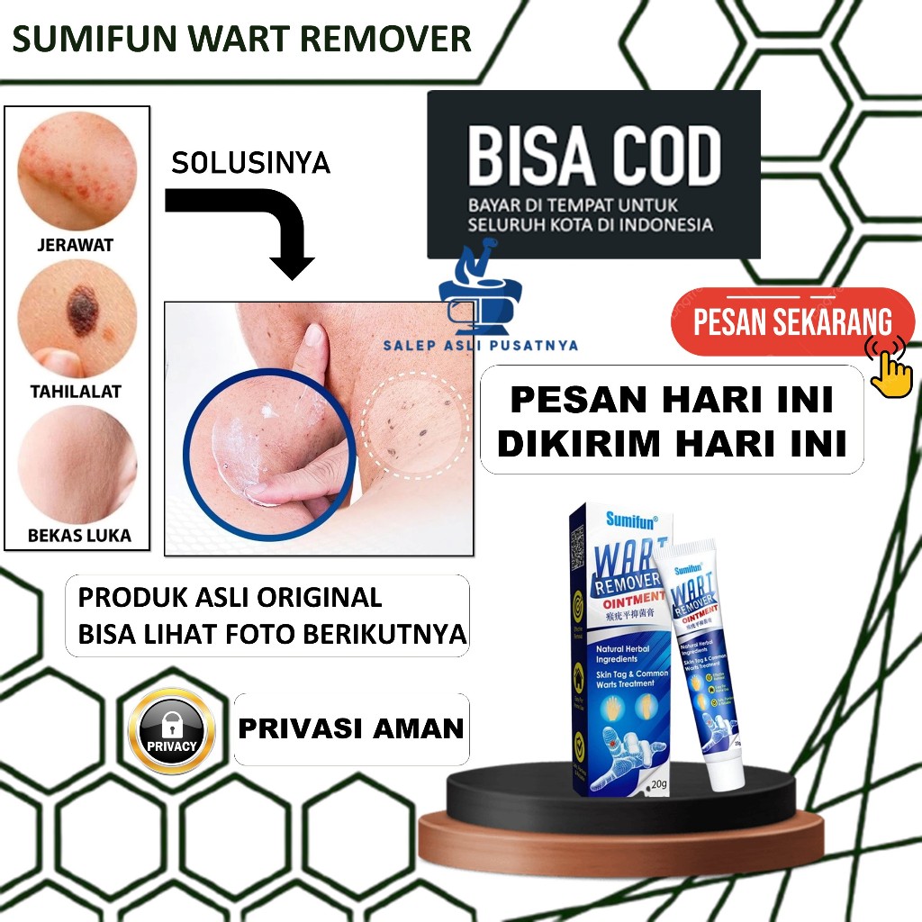 Penghilang Kutil Ampuh – Salep Sumifun Wart Remover Original