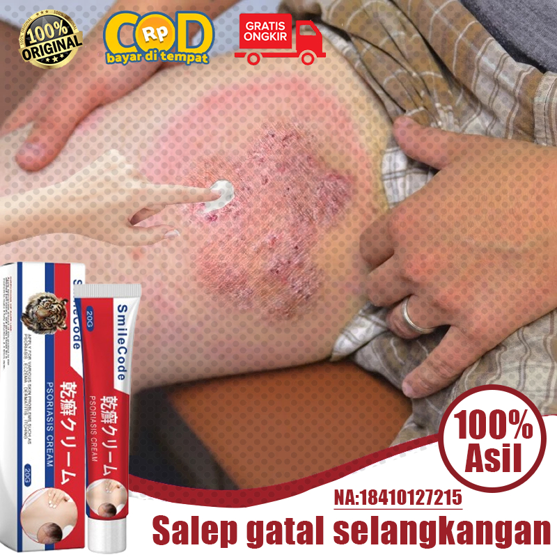 Salep gatal 0bat gatal gatal kulit eksim obt gatal selangkangan dan hitam salep eksim kering dan gat