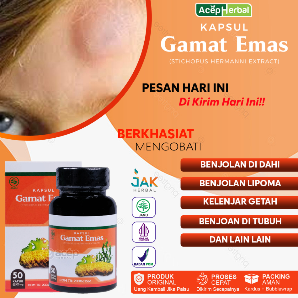 Obat Benjolan di Kening, Benjolan di Dahi, Benjolan di Jidat dan Benjolan Lipoma - Kapsul Gamat Emas