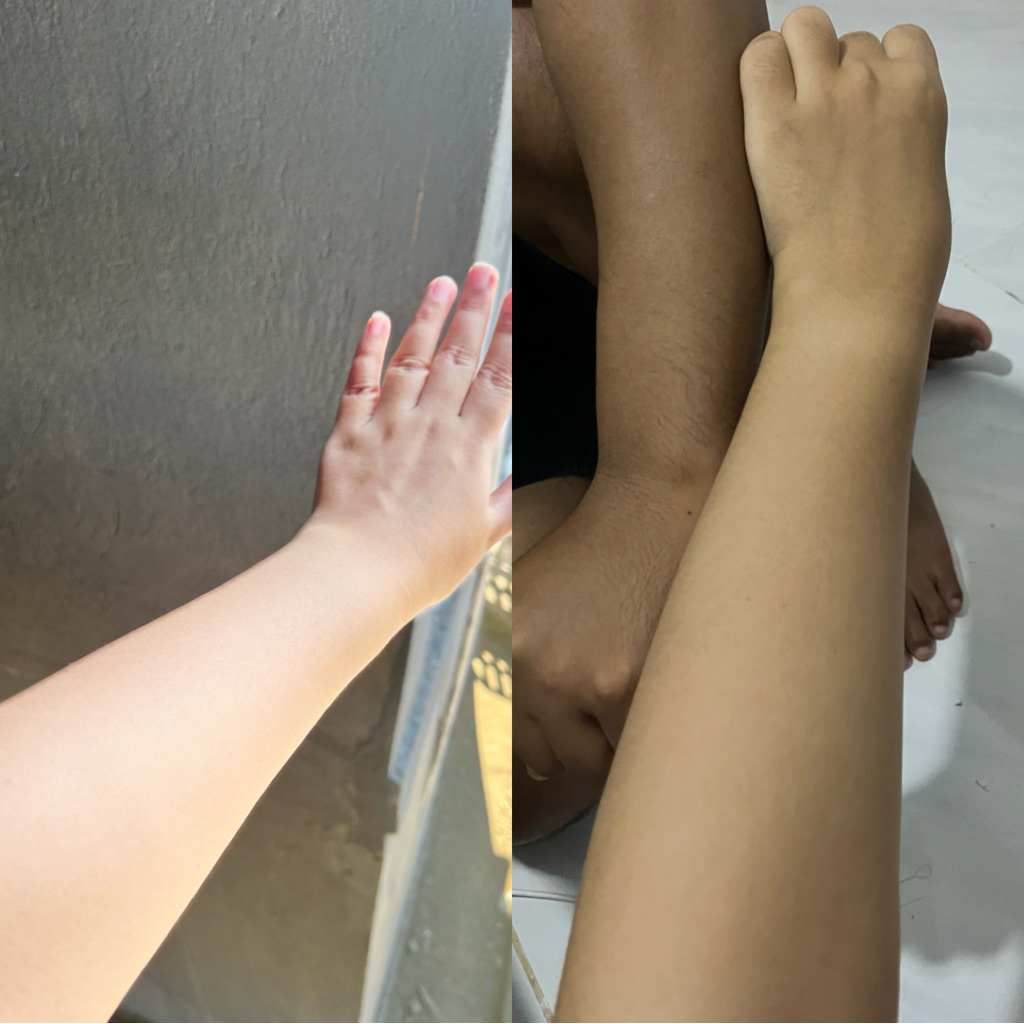 HB Whitening Dosting