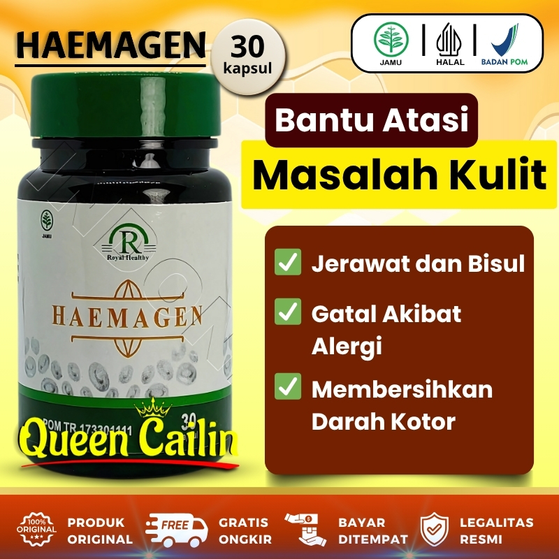 

Stiker Label Roll Custom Vinyl Anti Air | Free Cutting | Cetak Logo / Produk – ERKI PRINTING