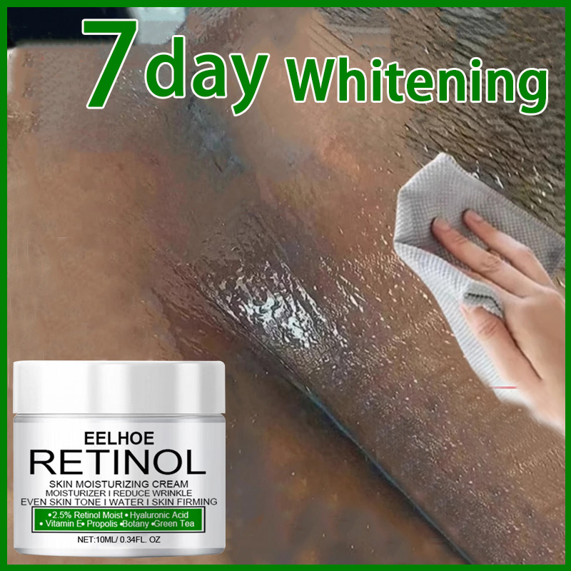 Krim Pemutih Ketiak Pemutih Selangkangan Vagina Pembersih Selangkangan Hitam Krim Pemutih Ketiak Pem