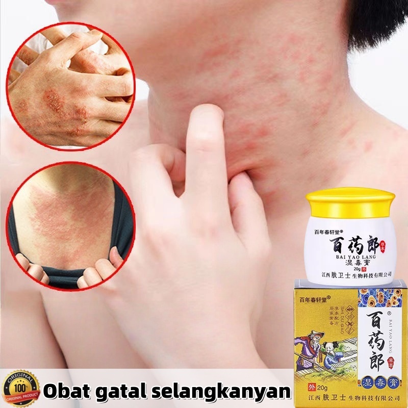 【100%Ori】Salep gatal paling ampuh Obat gatal selangkangan Salep gatal selangkangan Obat gatal gatal 