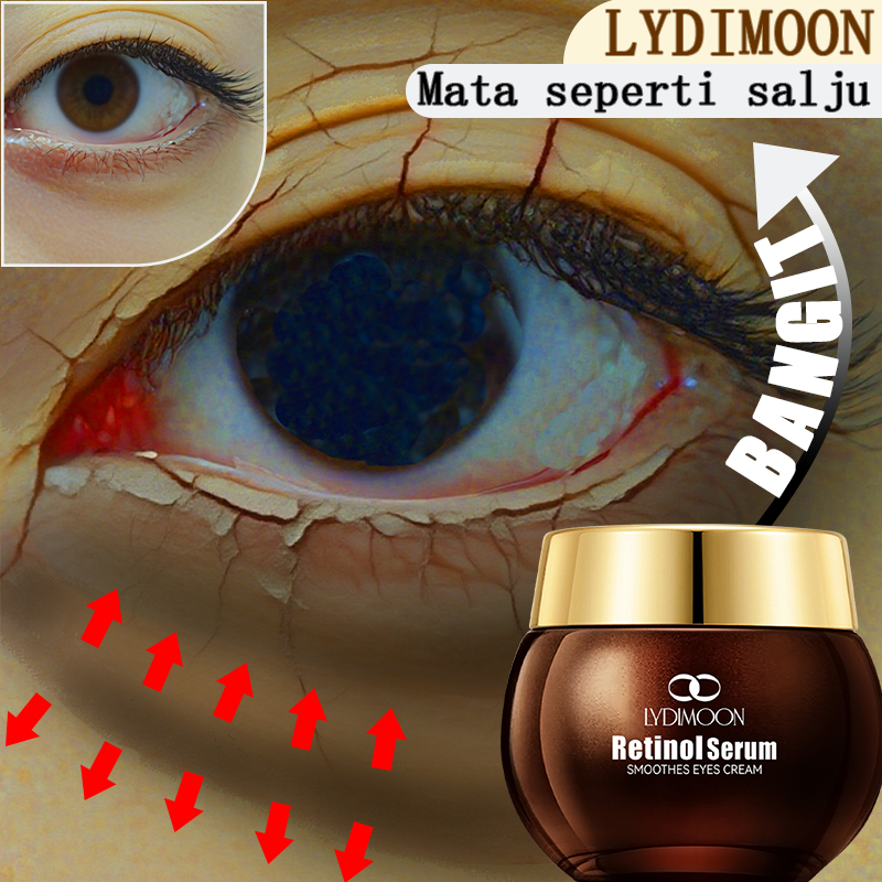 [LYDIMOON]Retinol Eye Cream Kantung Mata Ampuh / Kantung Mata Hilang Ampuh Cream Mata Retinol 35g