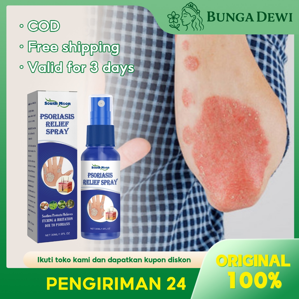 South Moon Psoriasis Relief Spray 30ml 0bat Gatal Gatal Kulit Seluruh Badan Obat Salep Semprotan Ant