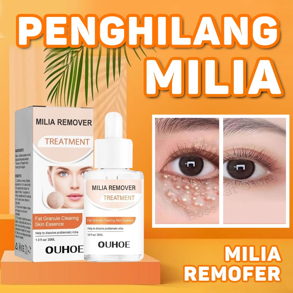 OUHOEE Penghilang Milia Paling Ampuh Obat Milia Serum Milia Milia Di Bawah Mata Serum Milia Di Bawah