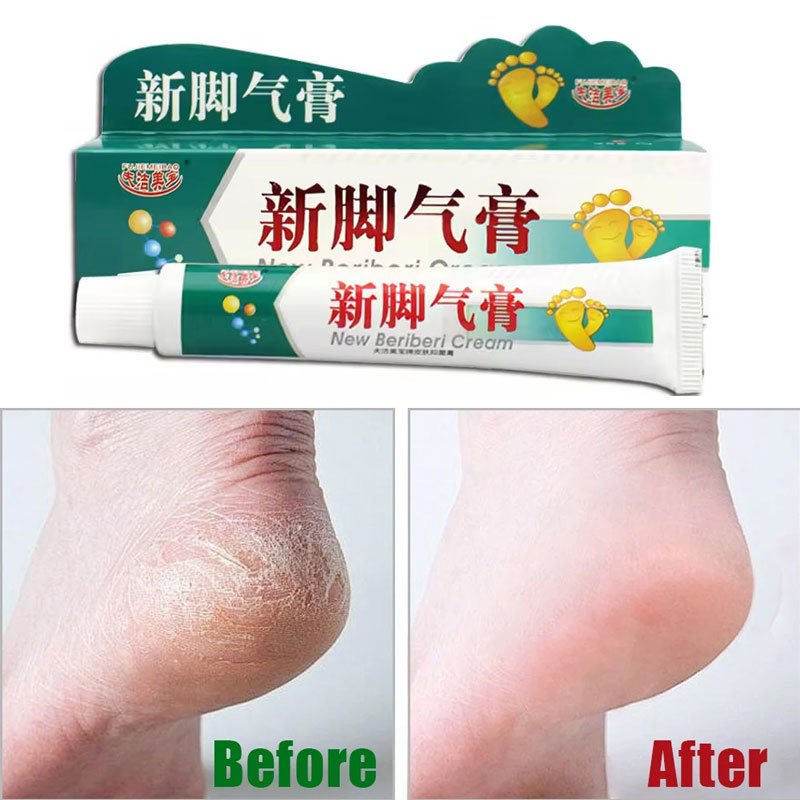 Cream Kaki Pecah dan Kering Perawatan Kaki Mulus Obat Salep Kaki Pecah-Pecah Pelembab Kaki Kering da