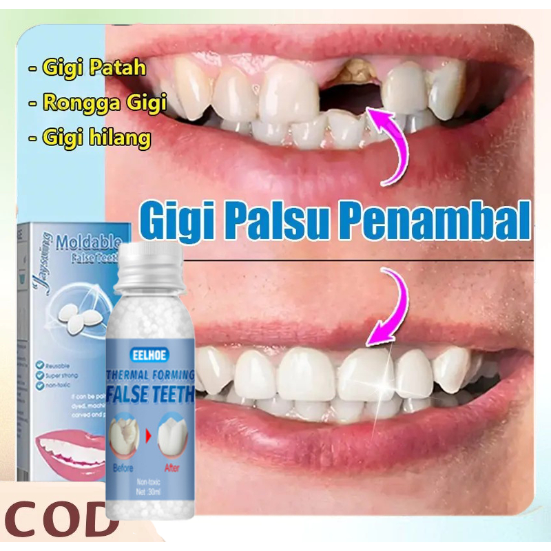 Gigi Palsu Penambal Pembentukan bebas Gigi Lem Gigi Palsu Permanen Tambalan Gigi Berlubang Tambal Gi