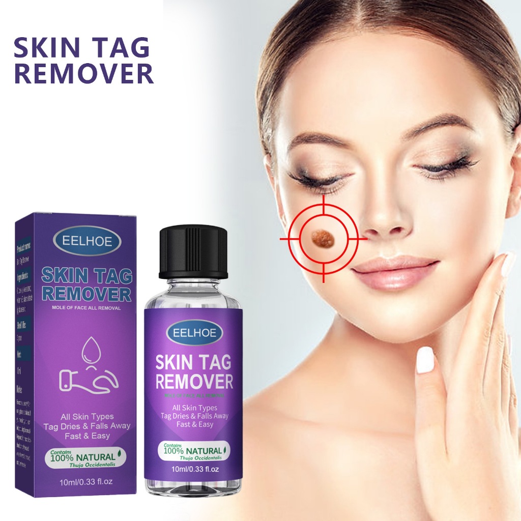 EELHOE Skin Tag Remover All Types Wart Removal Serum Wart Removal Skin Tag Menghilangkan Tahi Lalat 