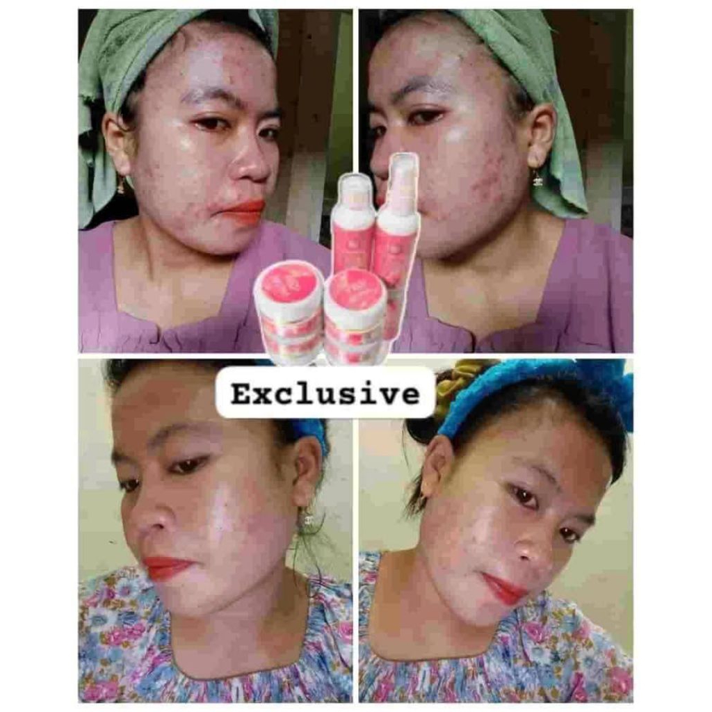 WSP EXCLUSIV BPOM/COD WSP/SKINCARE WSP EXCLUSIV/SKINCARE VIRAL WSP