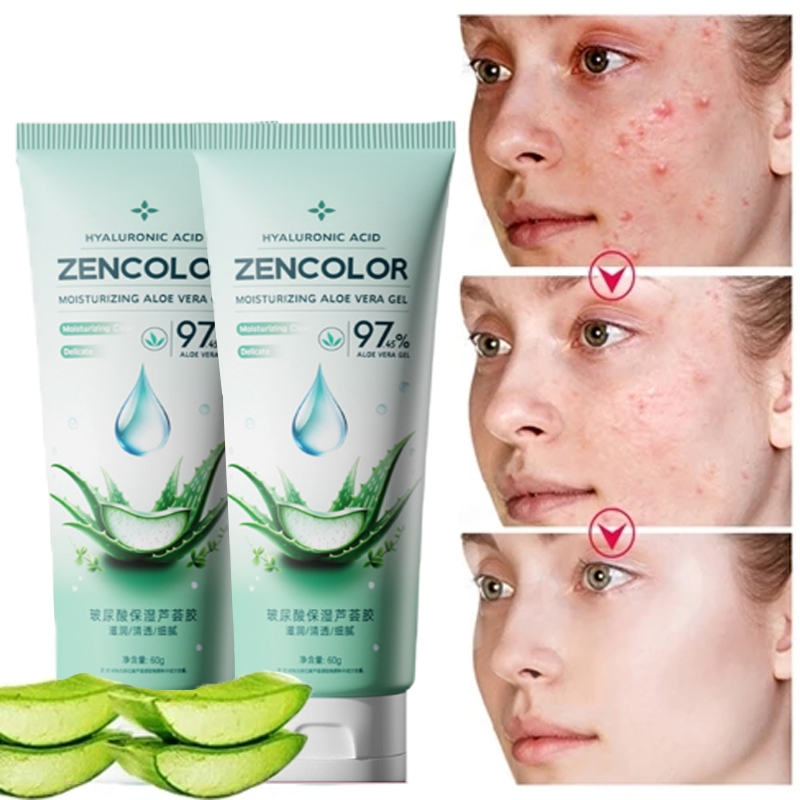 【Hadiah gratis】aloe vera gel Repair Skin bekas jerawat Pelembab gel lidah buaya lidah buaya gel untu