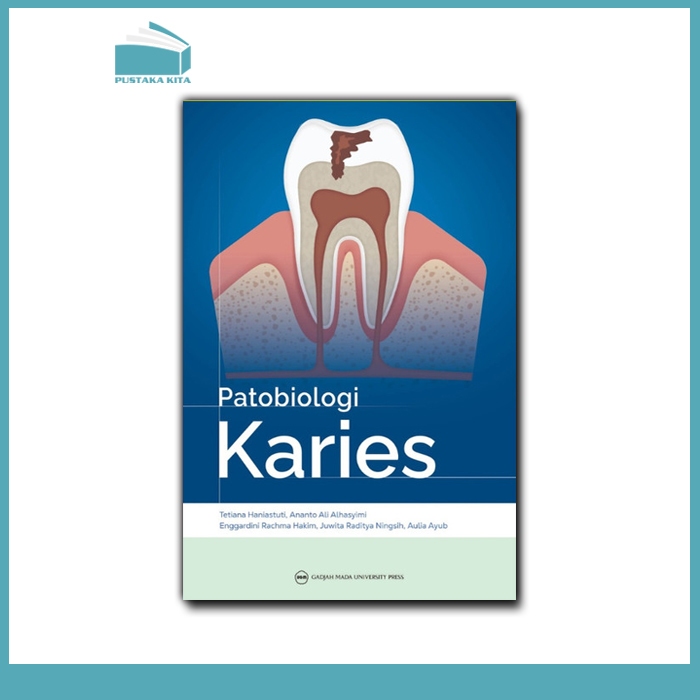 Patobiologi Karies - UGM Press