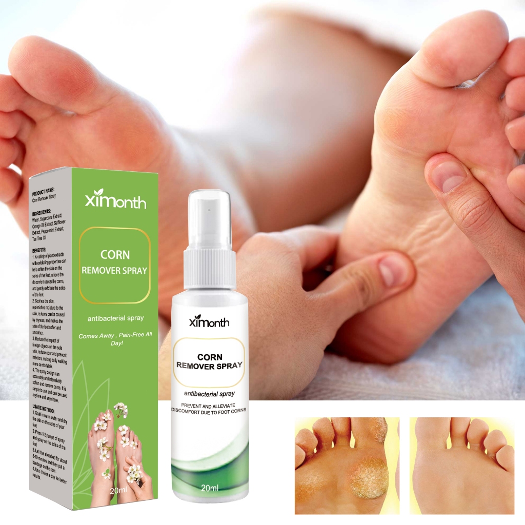 Ximonth Obat Mata Ikan Obat Kapalan Untuk Kalus Kapalan Kutil Mata Ikan