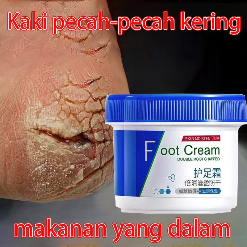Salep kaki kering dan pecah-pecah terkuat yang pernah ada Produk Perawatan Kaki Kering dan Kusam Pel