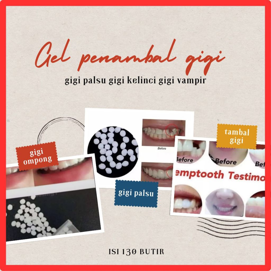 Gel penambal gigi pembuat gigi palsu gigi tiruan gigi ompong gigi patah