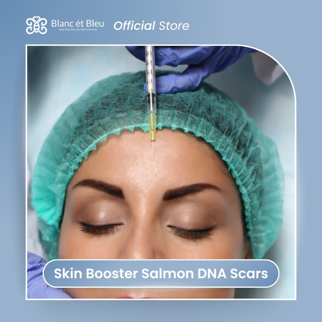 Skin Booster Salmon DNA Scars