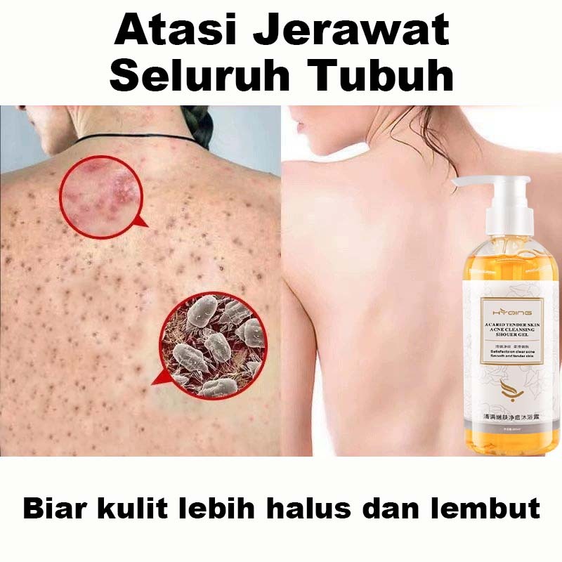 Body Wash Anti Jerawat Body wash k naturalwhite Body wash acne Body wash whitening Body wash antibac