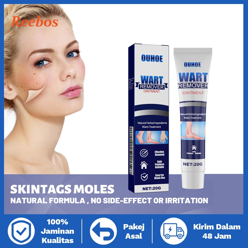 Reebos Krim Penghilang Kutil & Skin Tag - Salep Perawatan Kulit untuk Pria & Wanita, Wart Remover Se