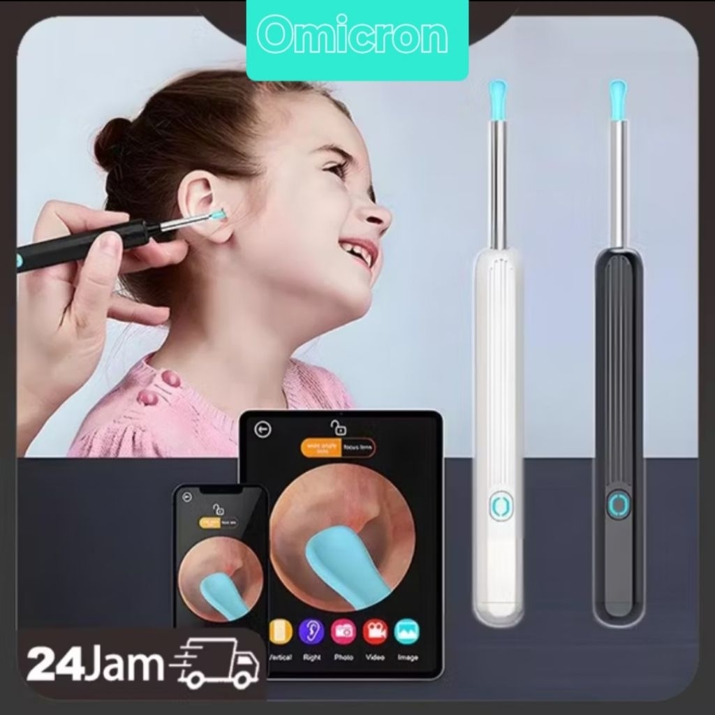 Pembersih Telinga Bayi Korek Kuping LED Bayi Pembersih Kuping Smart Kamera WiFi Hp Korek Kuping