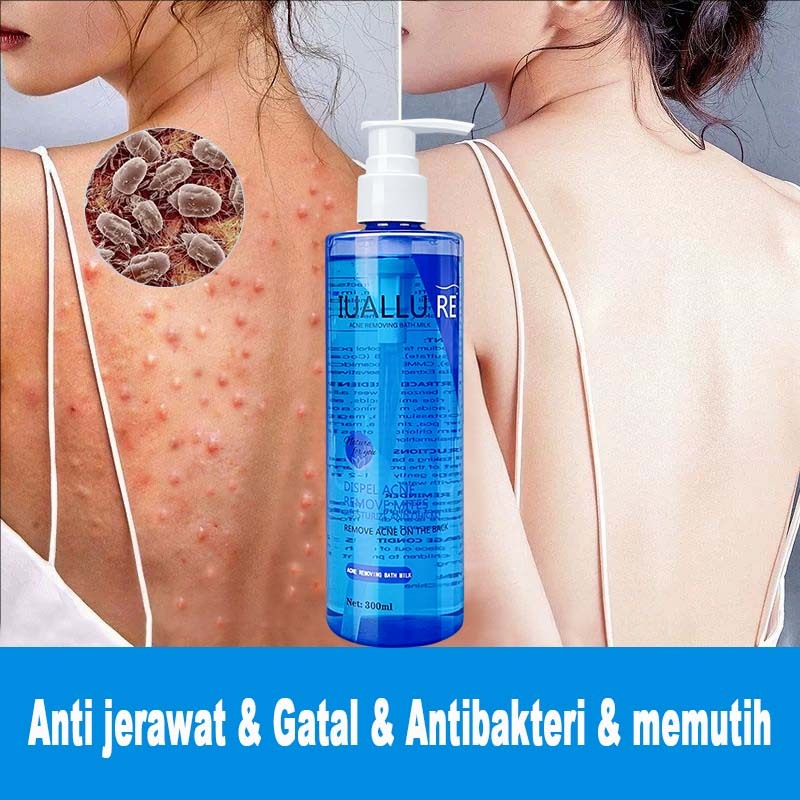 Body Wash Anti Jerawat Body wash antibacterial Body wash acne Body wash whitening Anti Jerawat Antib