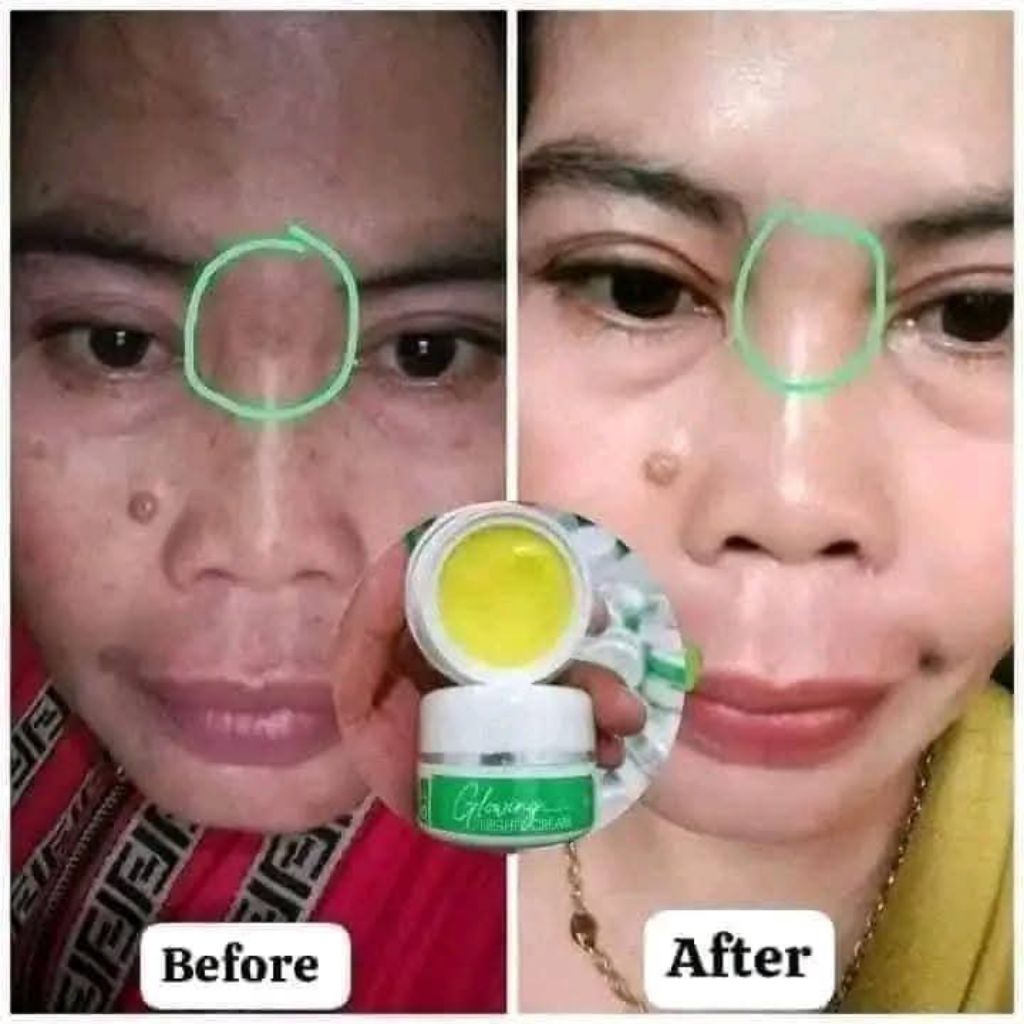 Night Cream Flek maxie hijau