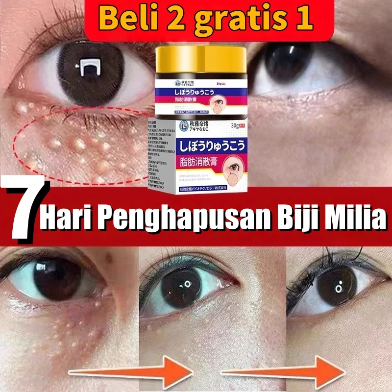 Penghilang Milia Paling Ampuh Eye Cream Obat Milia Salep Milia Di Bawah Mata Syringoma Penghilang Re