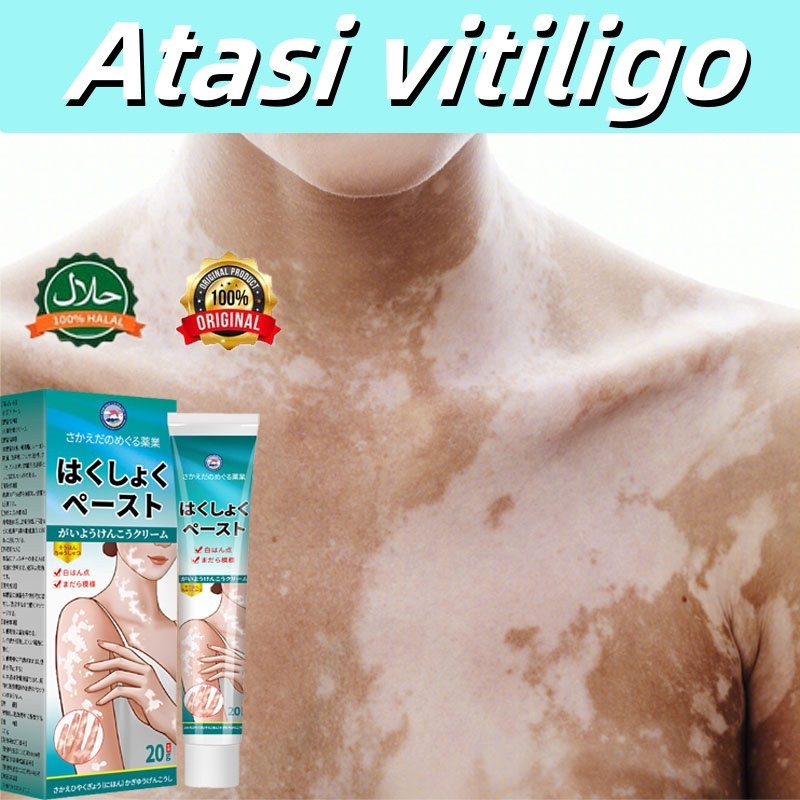 Salep khusus untuk vitiligo Krim bercak/Atasi Vitiligo, Kembali Warna Kulit Asli Atasi Vitiligo Viti