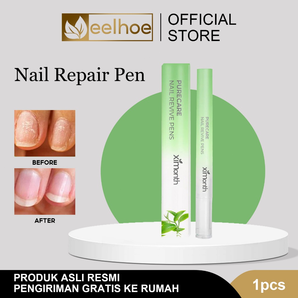 Ximonth Nail Repair Pen Pena Perbaikan Kuku Vitamin Kuku Mengkilap Vitamin Kuku Kering Dan Rusak Kuk