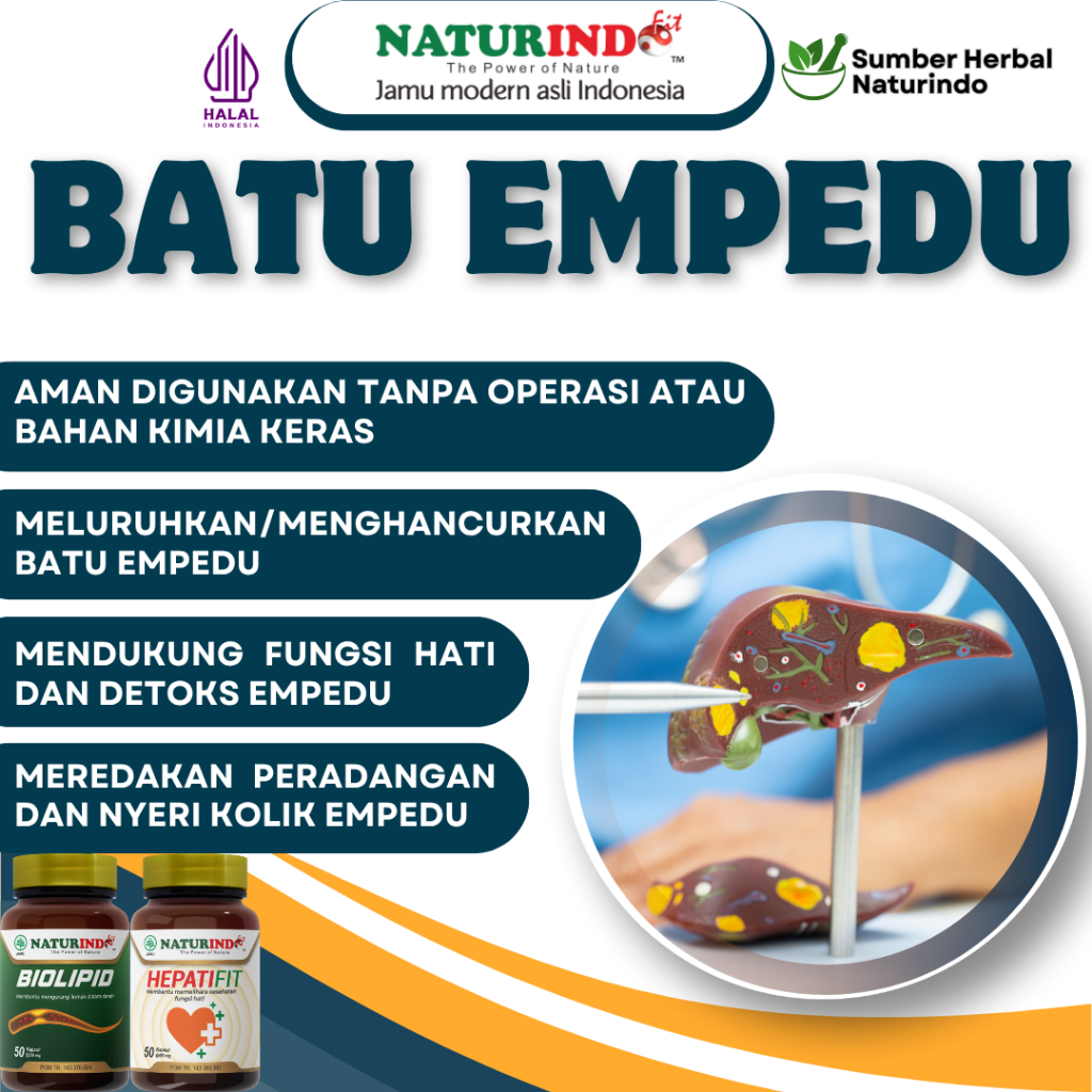 Batu Empedu Hancur Tanpa Operasi Naturindo Herbal Alami Meluruhkan Batu Empedu