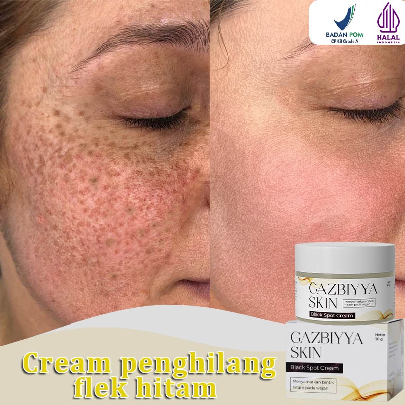 [BPOM]penghilang flek hitam membandel flek hitam di wajah membandel cream flek hitam membandel 30g p