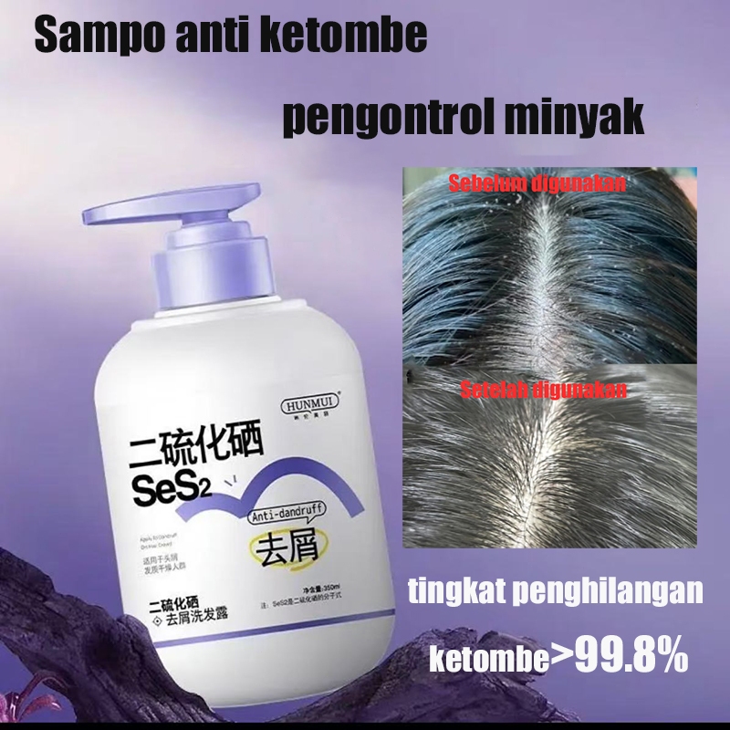 Shampo anti ketombe selenium dioksida  sampo anti ketombe Sampo Shampo anti ketombe dan anti rambut 
