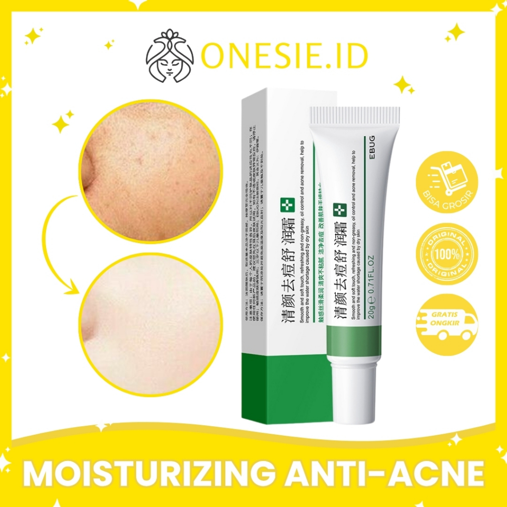 EBUG Anti Acne Moisturize Cream Krim Jerawat Pelembab Mengencangkan Wajah Jerawatan - Hijau VP030