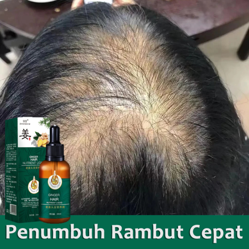 Serum Anti Botak Rambut hair oil rambut rontok penumbuh rambut penebal rambut serum penumbuh rambut 