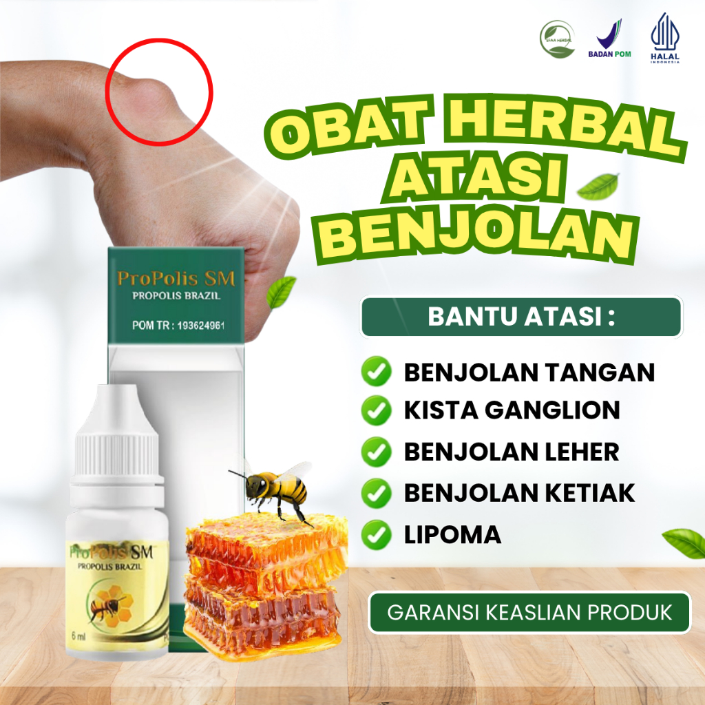 Propolis SM Obat Benjolan Ditangan, Obat Benjolan Dileher, Obat Benjolan Diketiak, Obat Benjolan Dip