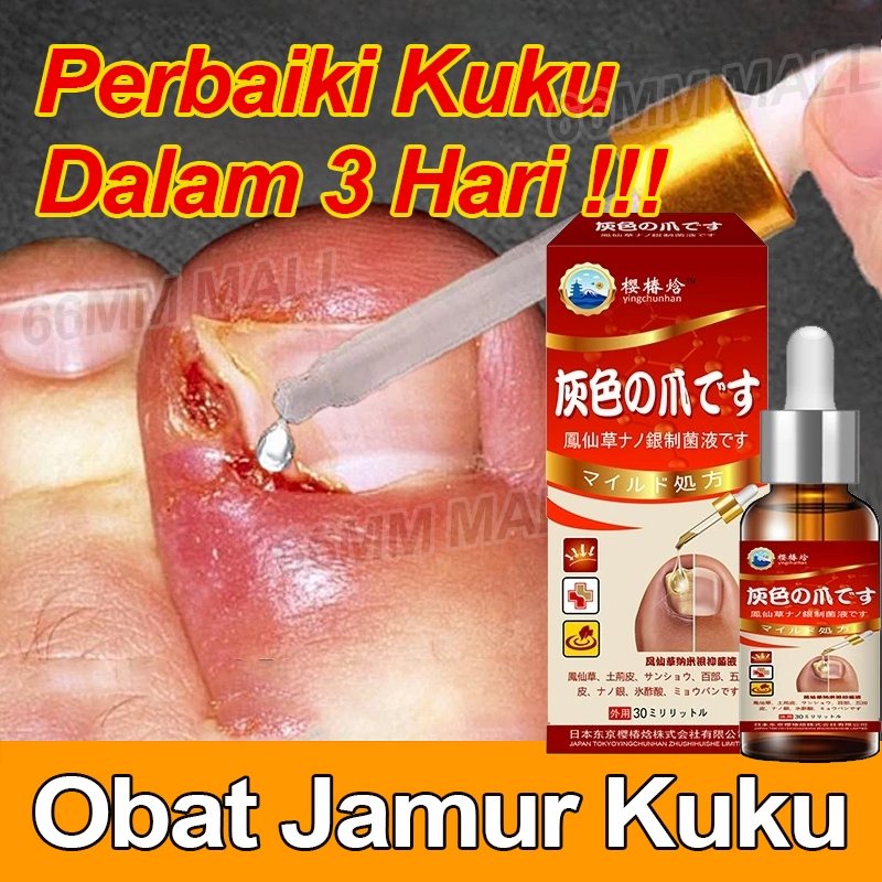 Serum Kuku Jamur Dan Rusak Obat Cantengan Jempol Kaki Kuku Obat Jamur Kuku Vitamin Kuku Dan Kutikula