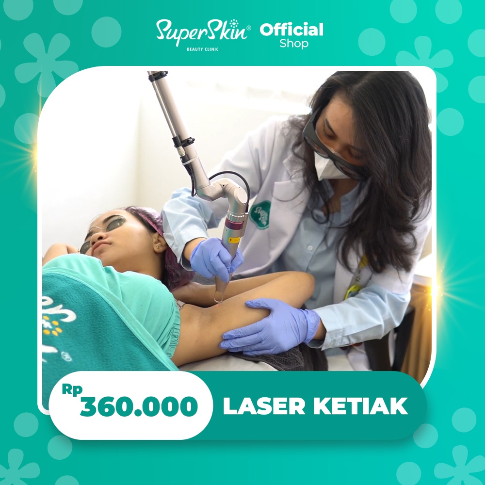 Superskin Treatment Laser Ketiak - Mencerahkan Ketiak - Mengatasi Ketiak Hitam